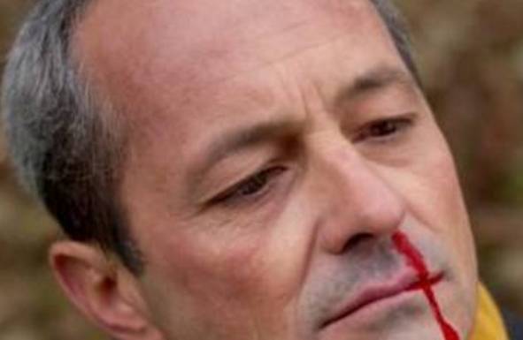 伤口|医生提醒：如果这6个症状你全有，很可能是患上糖尿病了！