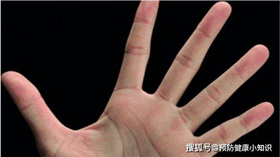 身上痒是癌症吗 30c945ab38154f208da3503d11b3d195.jpeg