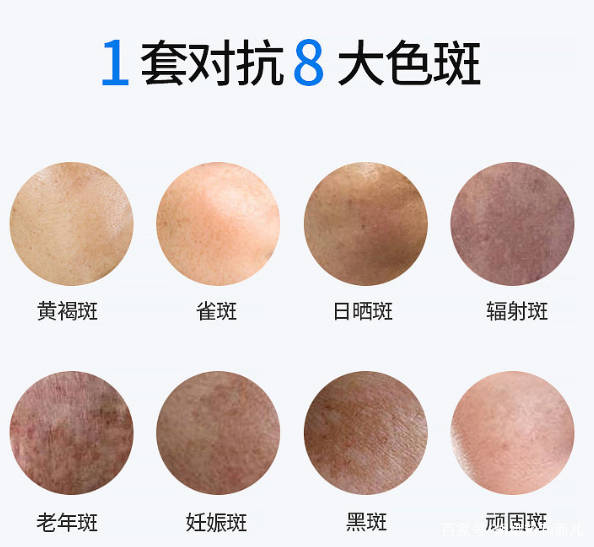 方法|怎么淡斑祛斑？祛斑霜的正确使用方法，看完这篇淡斑快1倍！