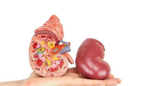 肾脏|肾结石太常见了?不想它“现身”,这3个很关键