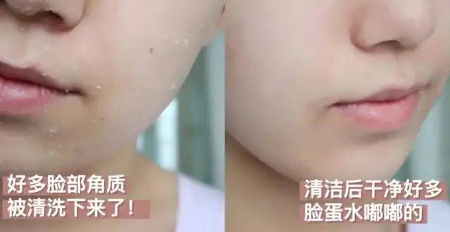 柳树|告别角质、死皮，给肌肤做个“大扫除”，还你净透柔嫩肌