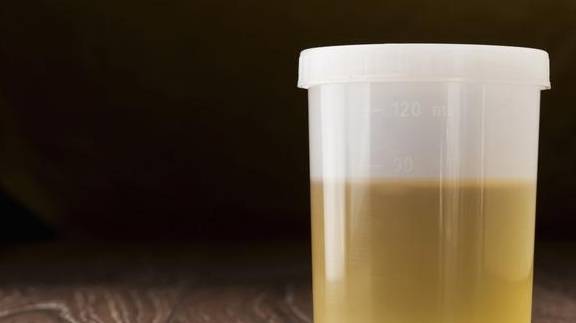 蛋白|延缓肾功能，避免尿毒症，做好3点控蛋白效果更好