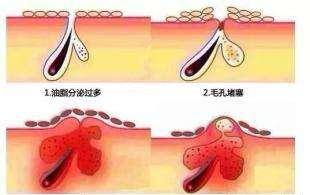 黑头|金晨是牛奶“泡大”的？穿吊带裙藏不住“水光肌”皮肤嫩得要出水