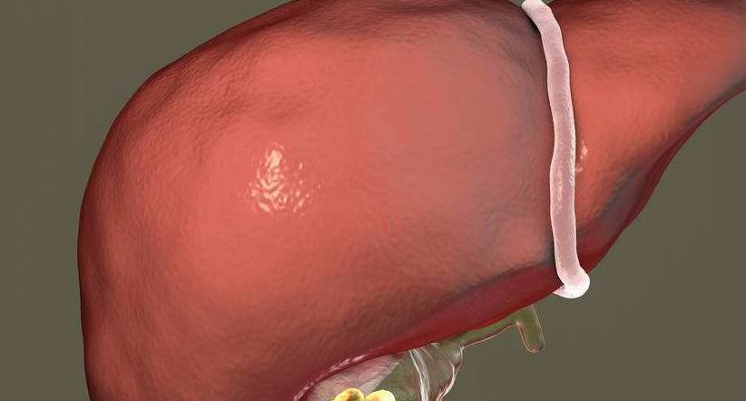 肝脏|肝变“硬”前，会发出3个信号，多做这3件事，慢慢逼走肝硬化