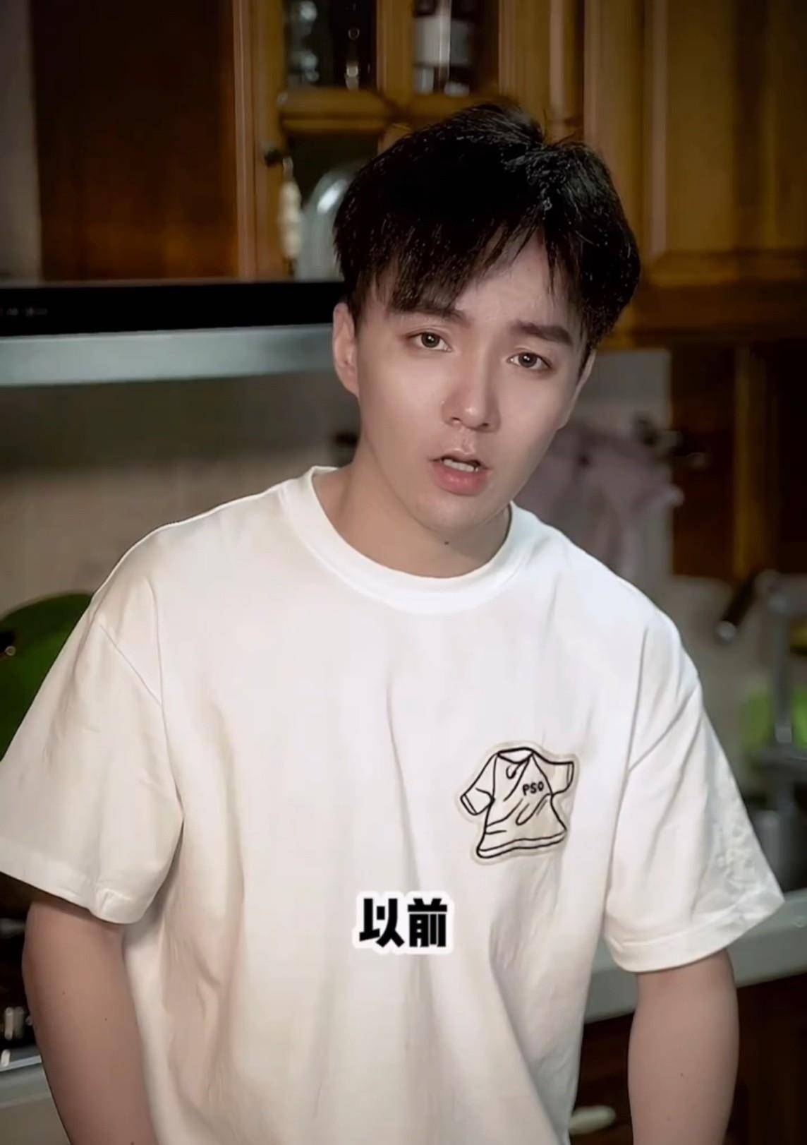 头皮|童星“三毛”因剃光头损坏毛囊，头顶缝300多针，现帅到认不出