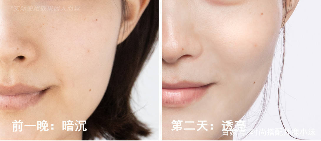 严重“带货一姐”薇娅节目上卸妆,素颜颜值严重降低,皮肤状态很真实