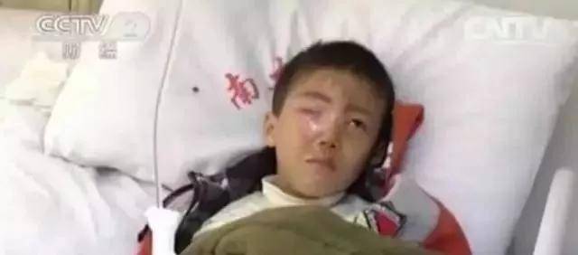 因为|20分钟可致失明!医生说这东西每家都有(家长们快收藏)