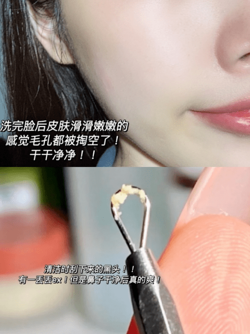 黑头净化毛孔深层清洁祛角质，用丽得姿天然成分的美白面膜泥