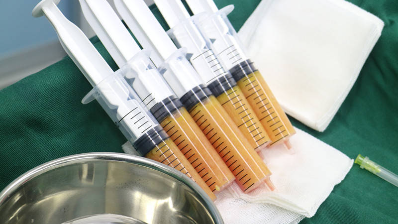 下唇你的唇形符合美学标准么 杭市一程含皛医生谈丰唇术