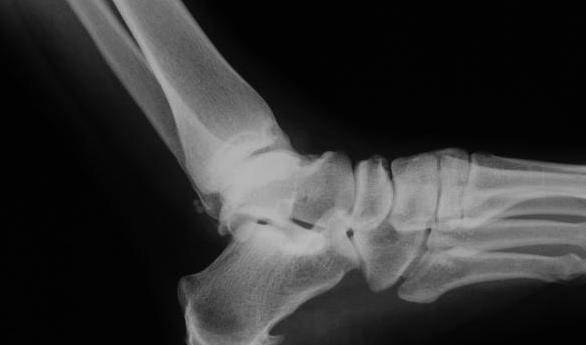 症状|医生辟谣：5种疾病病情只能控制，无法根治，别花冤枉钱了！