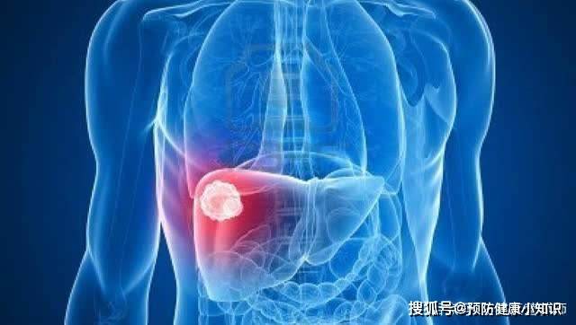 人体|肝癌的“祸根”找到了,4个习惯诱发肝癌,有一个也要改