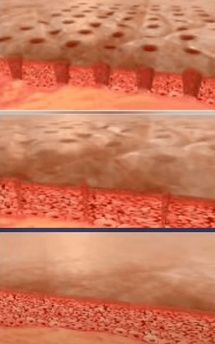 副作用皮肤美容项目这样搭配，抗老效果加乘