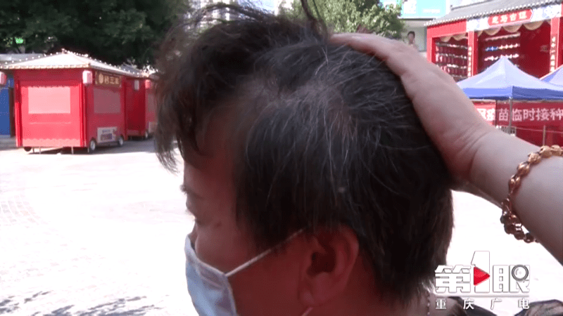 网友|女子花4万做“白发转黑”，结果治疗就是拔了白发
