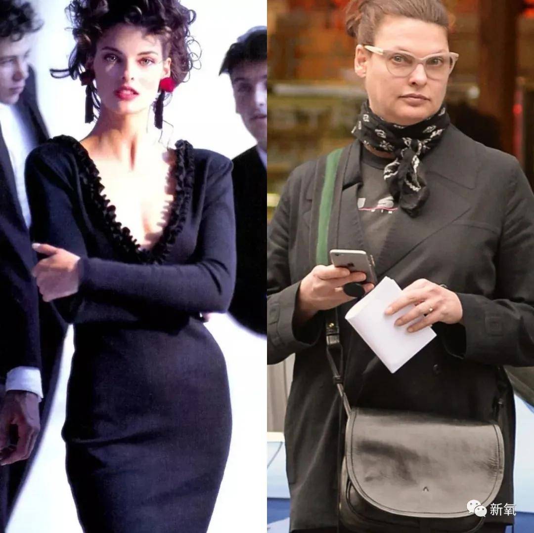 因为绝世美人因为冷冻溶脂毁容消失5年，轻医美没你想的那么轻！