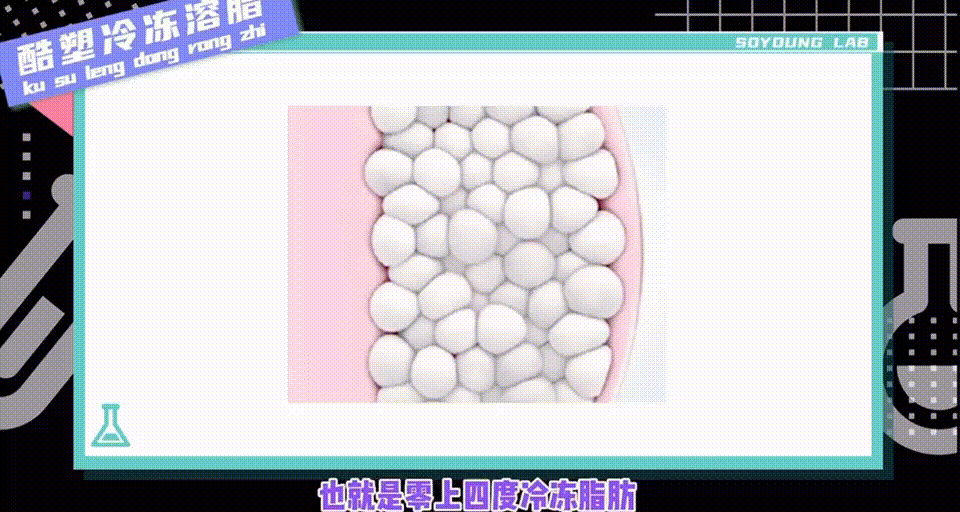 因为绝世美人因为冷冻溶脂毁容消失5年，轻医美没你想的那么轻！