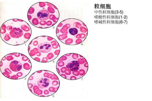 中性粒细胞偏高 来自搜狐网