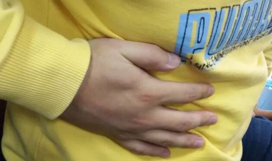 饮食|得了乙肝有什么东西不能吃?不想加重,平时再喜欢吃,也请住嘴