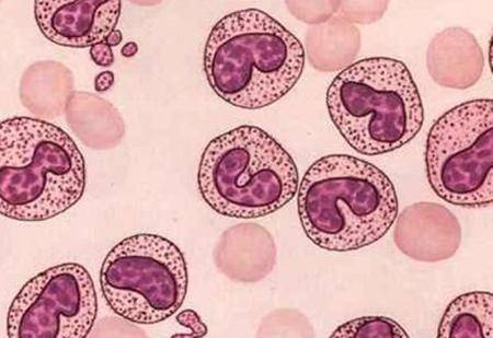 血常规|血常规检查中，若是这3个指标升高，别忽视了