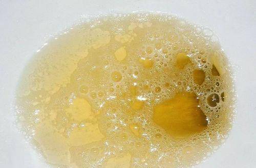 枕头|检查餐后血糖25,停药2个月却降为5.8,两个控糖诀窍不妨学习下