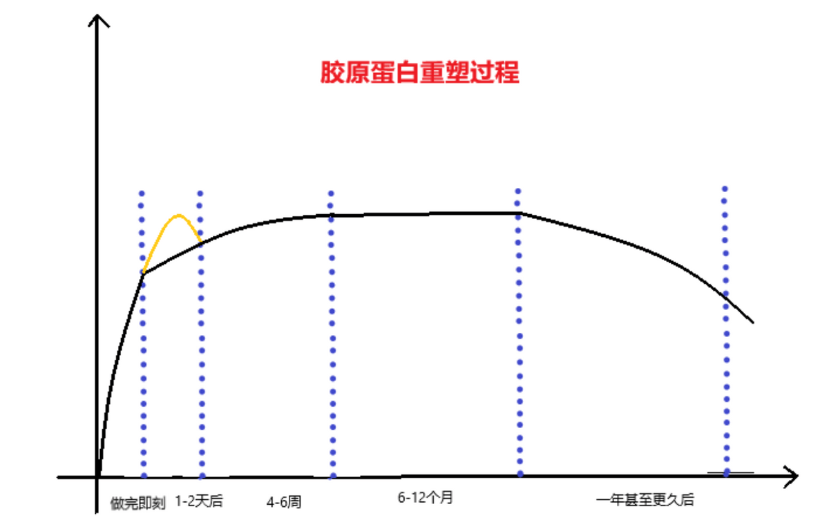 玛吉涨知识，欧洲之星的作用，欧洲之星和热玛吉哪个好？