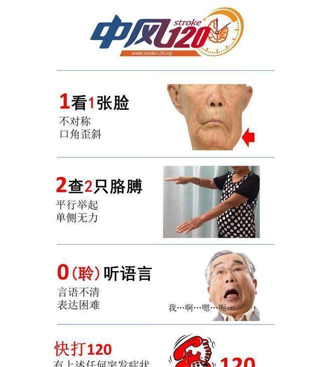 啥是小中风 7151d20008c04e74b15a1e83a56ac6ed.jpeg