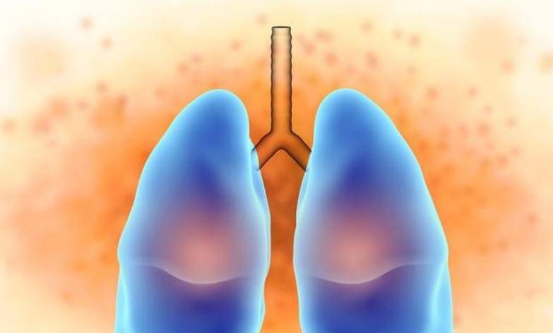 治疗|间质性肺炎在治疗过程中常见的误区都有哪些呢？