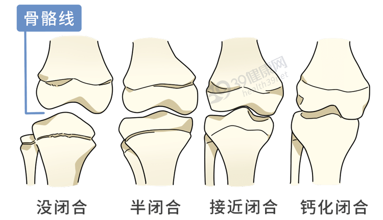 如果骨骺线尚未闭合,那么还是有可能再长高的.