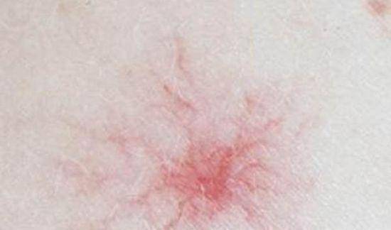 肝脏|想要保养肝脏,尽量要记住三点,进来了解下