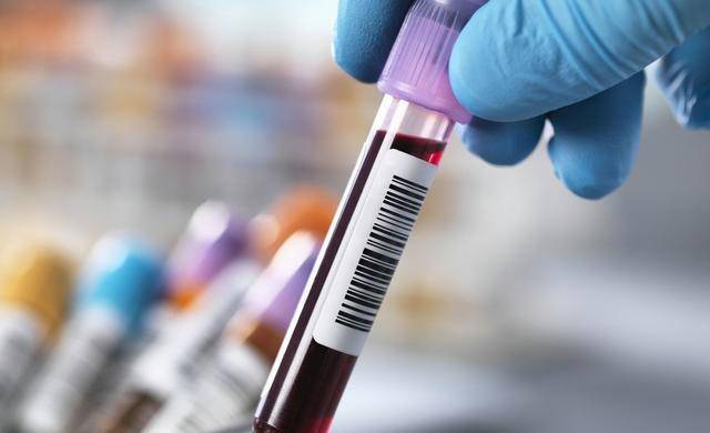 他汀|我对那个动脉有斑块的人说，最好不要停用他汀，原因是什么？