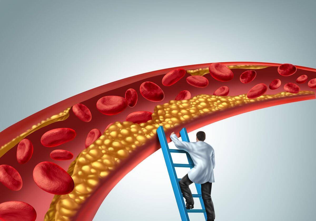 他汀|长期服用他汀类药物的时候,最应该注意的几个问题,不能忽视