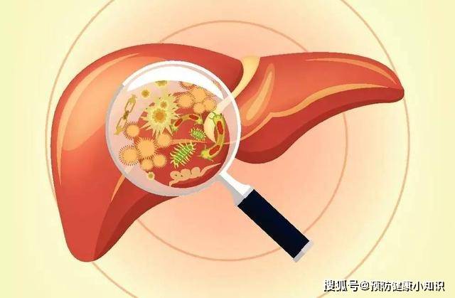 治疗|乙肝携带者有可能发展成肝癌吗?遵循以下原则,或有希望治愈