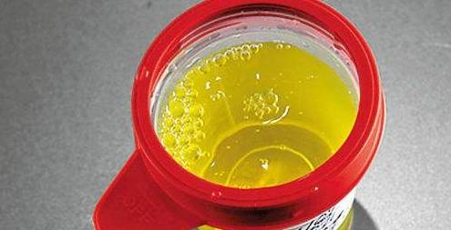 症状|提醒：40到55岁是“养命关键期”，请别忽视这3个器官的病变症状