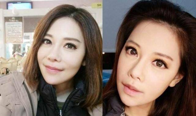 因为她是娱乐圈整容狂魔，连续整容高达60多次，后遗症却让她非常苦恼