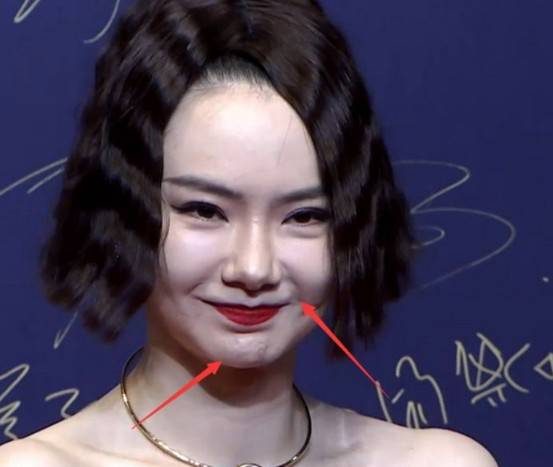 假发假发可不是随便选的，戚薇带着假发却暴露发际线，造型不太成功