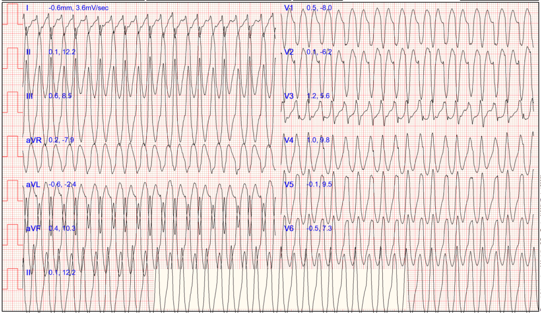 检查|装病？32岁女子一干活就晕倒！婆家人也不理解
