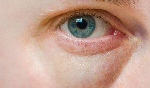 肾脏|脸色不好别总以为是没休息好，忽略疾病的信号，后果不堪设想！