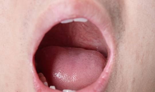 口苦是什么原因吃什么 4e9ba40e5f684eb4b21e37ac70b3d5d9.jpeg