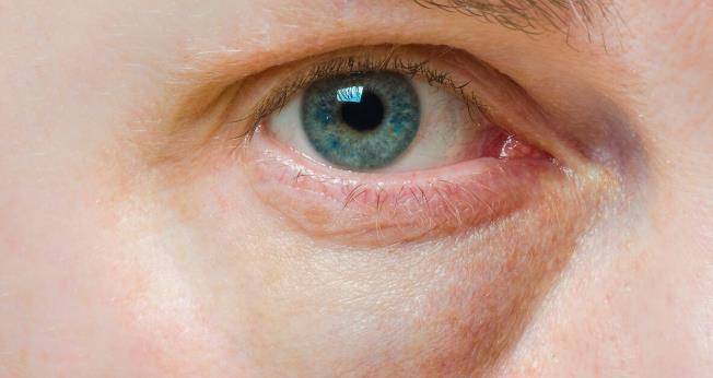 肠胃|不想尿毒症找上门？早晨留意4个征兆，一旦发现及早治疗