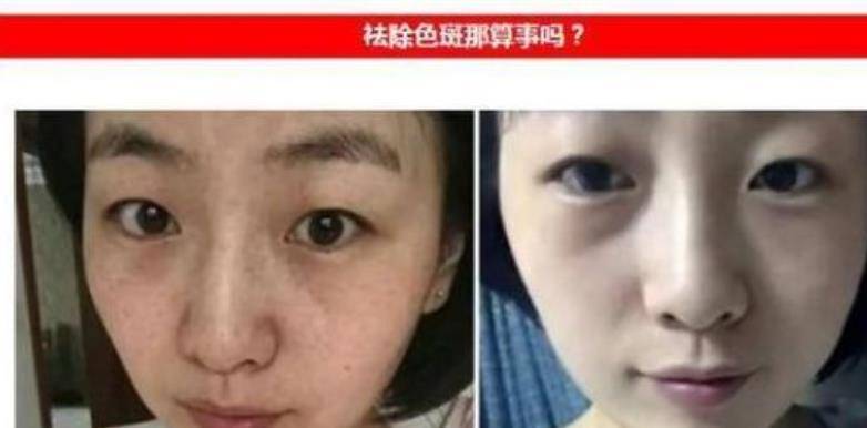 方法阿莫西林只要一粒，睡前擦脸，7天斑点皱纹不见了，脸蛋白净年轻