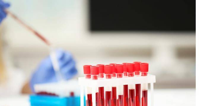 肾脏|肌酐升高后，防范尿毒症也不晚！稳住肾功能照着2步走