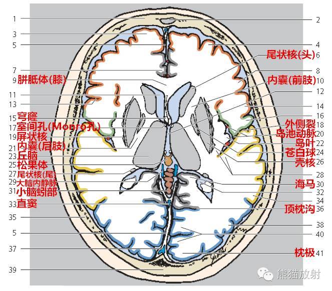 解剖顱腦ct斷層中英文對照乾貨滿滿