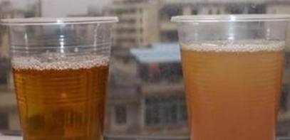 血液|身体有“四种反应”，是肝脏出了问题，抓紧三个黄金时间养肝吧！