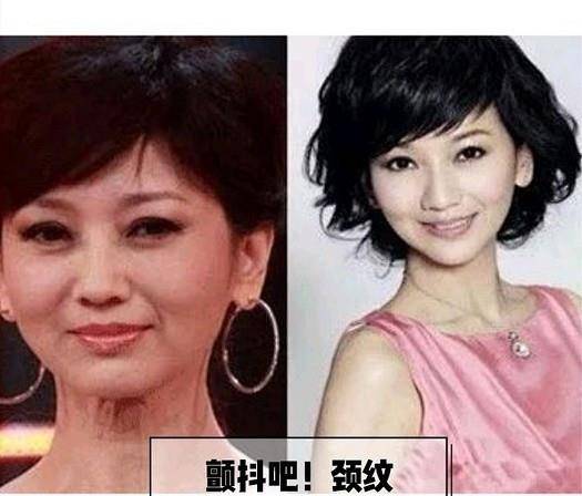 品牌忆龄颜值说：保持“颈”要时刻，不然真的会让人显老！