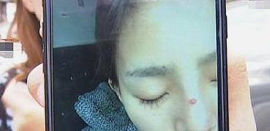 因为24岁姑娘瞒着家人整容，花费8万，被姐姐发现后：整跟没整一样！