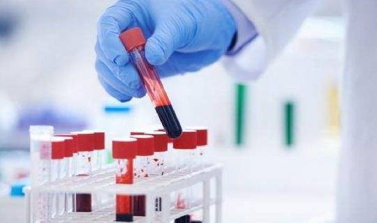 肾脏|肾友避免肾衰竭,这2件事比降肌酐更关键,别大意