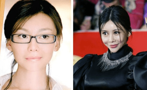 娄艺潇动脸的7位女星，一个比一个神奇，有人请医美专家鉴定自己纯天然