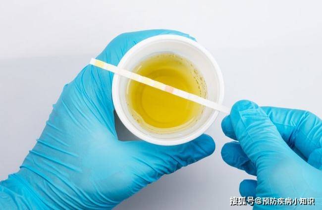 肝脏|肝不好，人先老！3个表现是肝脏在求救，别不当回事