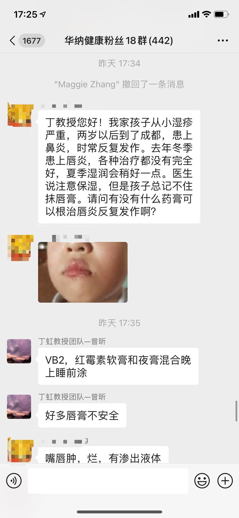 治疗箹诗工坊：小孩患上了唇炎该怎么办？