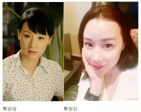 让人痛心的整容女星,曾是苦情剧女王,如今沦为女配变脸认不出_姚芊羽