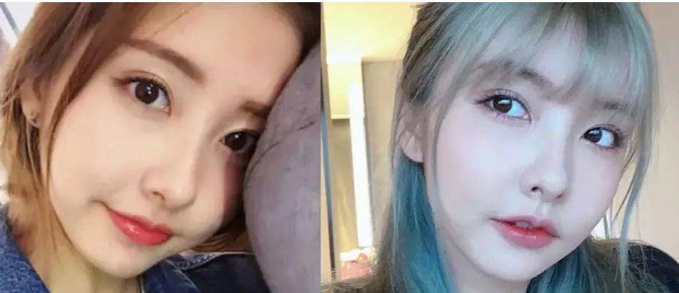 整形这是我见过最敢的女星,猪鼻子还能演美女?